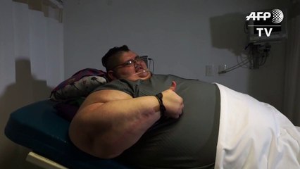 L'homme le plus gros du monde va tenter de perdre 300 kg