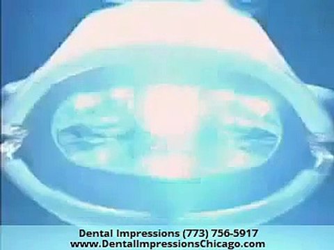 Opalescence Boost Teeth Whitening Chicago IL
