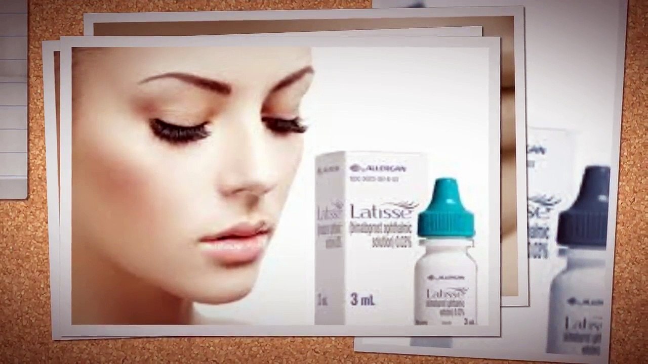 Bimatoprost for longer eyelashes