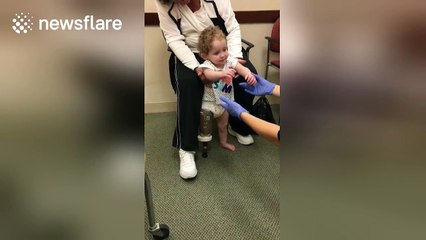 Twenty month old girl takes first steps with prosthetic leg