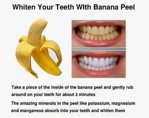 Teeth whitening with Banana Peel