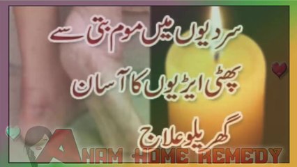 Phati Airyon Ka Garelu Ilaaj  پھٹی ایڑیوں کا سستا علاج