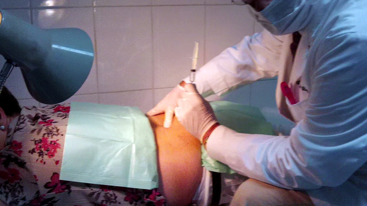 ozonoterapia discolisis paravertebral Dr Manuel Diaz