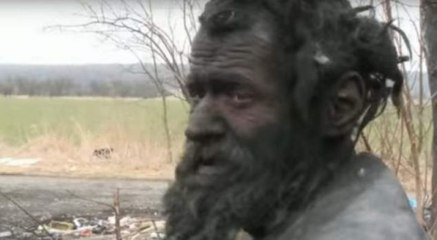 Ky njeri nuk është larë që 60 vjet, jeton në gropë