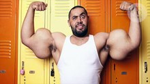 Un bodybuilder perd ses biceps après une injection à l’huile de coco