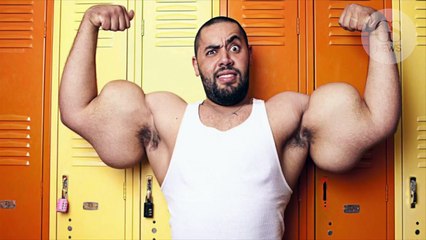 Un bodybuilder amputé des biceps après une injection à l’huile de coco