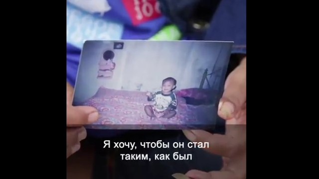 Родители в Индонезии посадили 10-летнего сына на диету, только когда его вес достиг 188 кг.