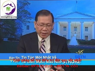 Thông tin mới về chứng Tai biến mạch máu não (STROKE)