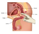 How Is An Enlarged Prostate And Benign Prostatic Hyperplasia Diagnosed?