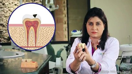 What is tooth Cavity and how can it be prevented