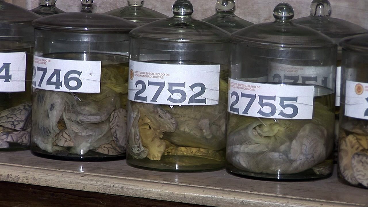 Im Kabinett der kranken Gehirne