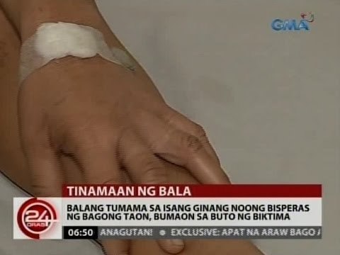 24 Oras: Balang tumama sa isang ginang noong bisperas ng bagong taon, bumaon sa buto ng biktima