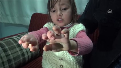 Yapışık parmaklı çocuğa hayırseverler sahip çıktı