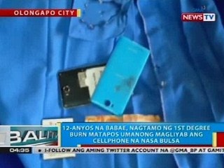 12-anyos na babae, nagtamo ng 1st degree burns matapos umanong magliyab ang cellphone na nasa bulsa