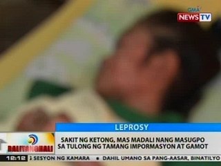 BT: Sakit ng ketong, mas madali nang masugpo sa tulong ng tamang impormasyon at gamot