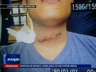Saksi: 2 pulis, sugatan nang saksakin sa loob ng police outpost