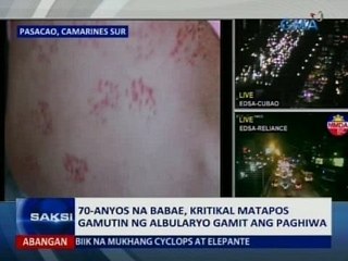SAKSI: 70-anyos na babae, kritikal matapos gamutin ng albularyo gamit ang paghiwa