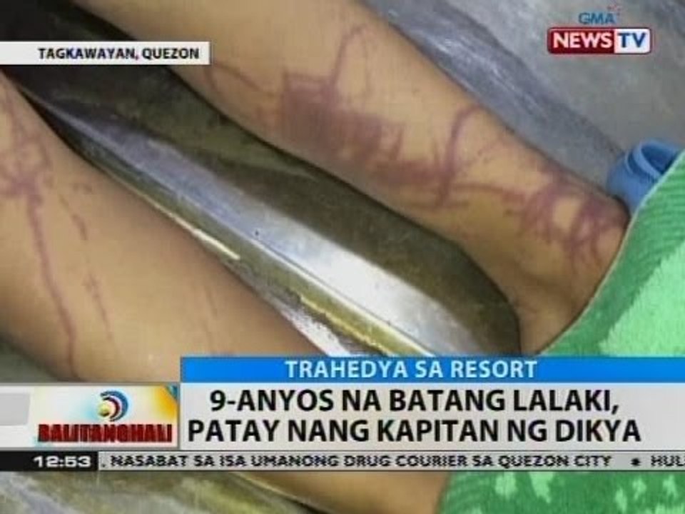 BT: 9-anyos na batang lalaki, patay nang kapitan ng dikya