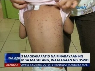 SAKSI: 3 magkakapatid na pinabayaan ng mga magulang, inaalagaan ng DSWD