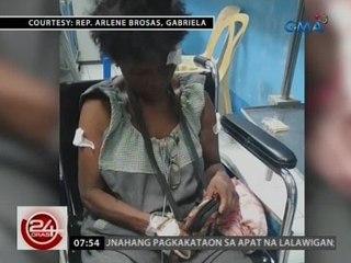 24 Oras: Limang nasugatang demonstrador, nananatili pa rin sa ospital
