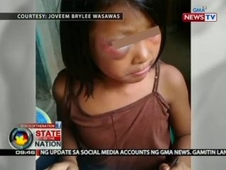 SONA: 6-anyos na batang babae, pinaghahataw ng kahoy ng kanyang nanay na may breast cancer
