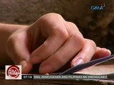 24 Oras: Dalagitang dating hirap dahil sa bukol sa ilong, magaling na matapos maoperahan