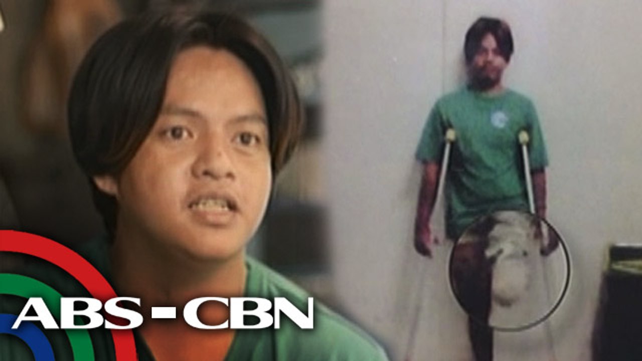 Red Alert: Life after firecracker accident