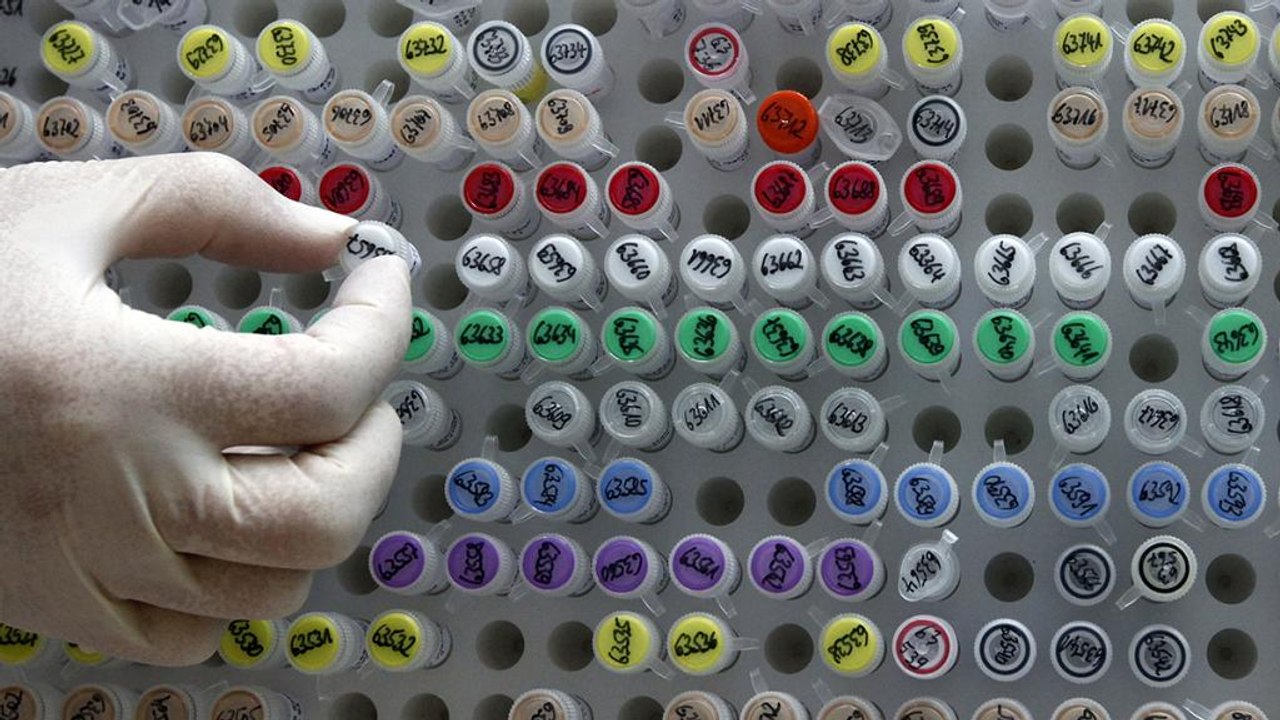 Niederlande: 26 Frauen möglicherweise Frauen mit falschem Sperma befruchtet