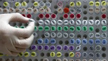 Branle-bas dans une clinique néerlandaise : des échantillons de sperme auraient été inversés
