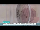 CDC confirms link between Zika virus and microcephaly