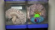 El cerebro humano tiene su propio museo en Lima