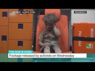 The War In Syria: Interview with Clement Saccomani on the images of the 5-year-old bomb victim