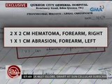 24 Oras: Exclusive: Batang may ADHD, sinaktan umano ng guro habang naglalaro
