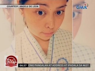 24 Oras: Angelu de Leon, ipinakita ang epekto ng bell's palsy sa kanyang mukha