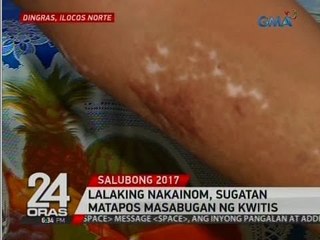 24 Oras: Lalaking nakainom, sugatan matapos masabugan ng kwitis