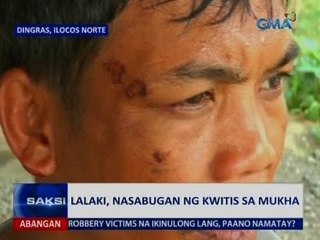 Saksi: Lalaki, nasabugan ng kwitis sa mukha
