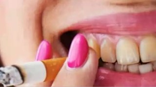 How To Remove Tobacco Stains From Teeth