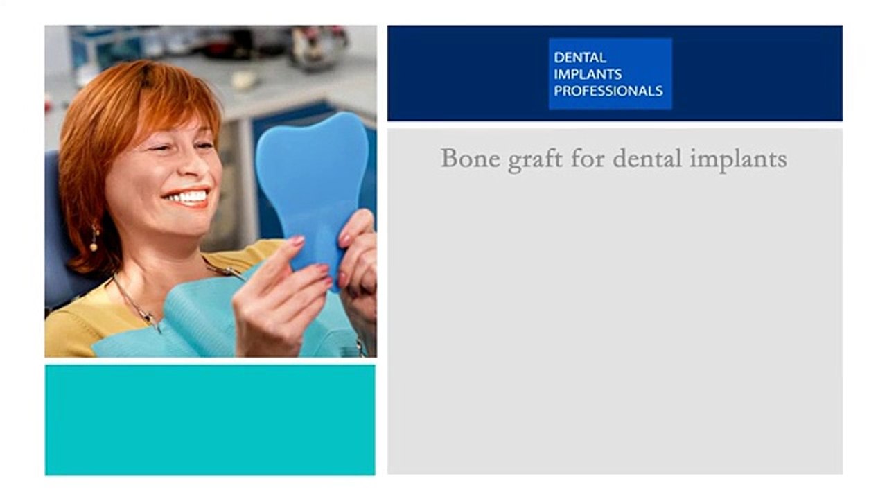 Why Bone Graft For Dental Implants? - Watch Now!