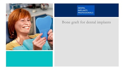 Why Bone Graft For Dental Implants? - Watch Now!