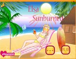 Permainan Elsa terbakar matahari - Play Elsa Sunburned