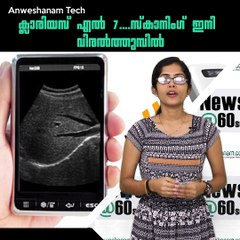 new divice for ultra sound scaning