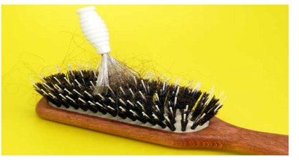 Signs and Symptoms of Hair Loss in Men