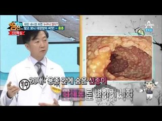 '용종' 알고 보니 대장암의 씨앗?!_채널A_나는몸신이다 55회