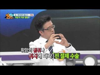 위암 치료 방법 A to Z! 진행 상태에 따라 다르다?!