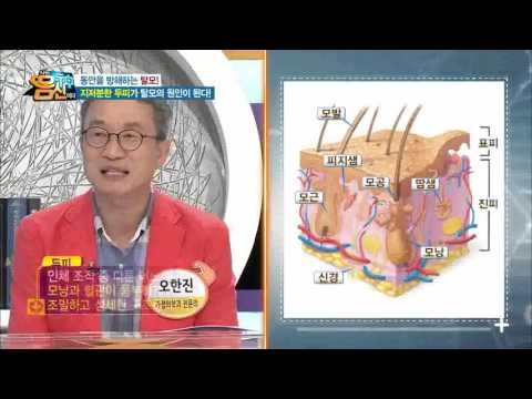 두피 관리로 탈모 잡아라! 지저분한 두피는 탈모의 원인?!