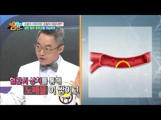 지구 두 바퀴 반 길이의 혈관, 관리 안하면 손발 절단까지 부른다!