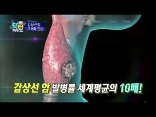 [예고] 갑상선암 수술만이 답일까? 갑상선암 오해와 진실
