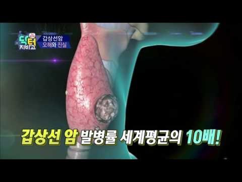 [예고] 갑상선암 수술만이 답일까? 갑상선암 오해와 진실