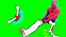 Spiderman Breaks His Leg Bones! W/ Frozen Elsa, Maleficent, Joker, Captain America in real