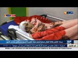 البليدة  التكفل بثلاث أطفال ضحايا إنفجار قنيلة تقليدية بمستشفى فرانس فانون